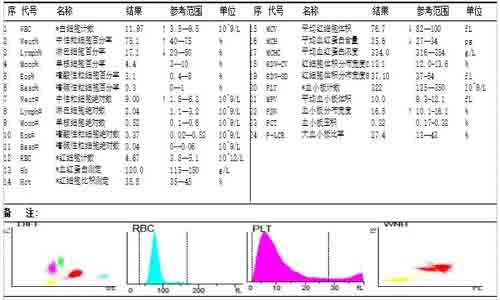 这个病例广东常见！地中海贫血筛查案例